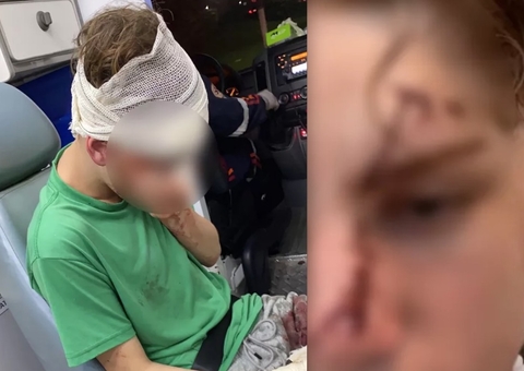 Influencer de 16 anos tem rosto desfigurado após levar garrafada