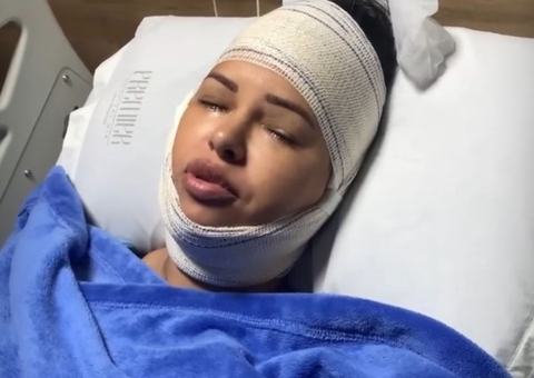 Ex-bbb Ariadna faz recauchutagem e mostra fotos após 3 cirurgias plásticas 