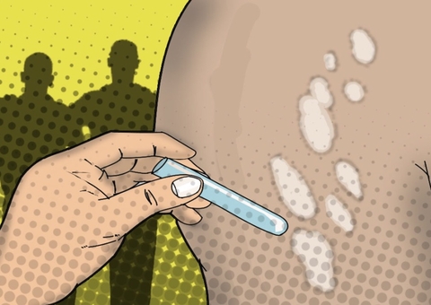 Amazonas adere à campanha global de combate à hanseníase