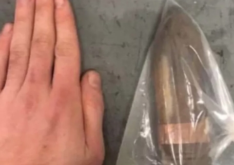 Homem tem projétil de canhão enfiado no ânus e hospital aciona equipe antibomba