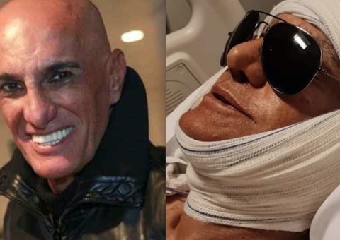 Amin Khader faz sétima cirurgia plástica: 'será que estou viciado?'