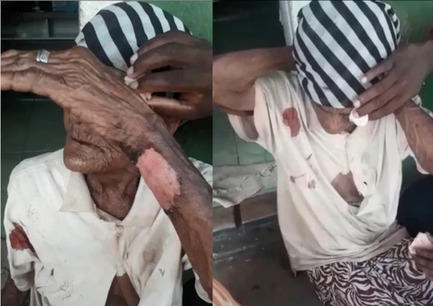 Idosa de 103 anos é espancada em assalto na BA