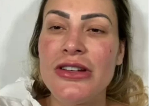 Grávida, Andressa Urach segue internada para evitar parto prematuro 