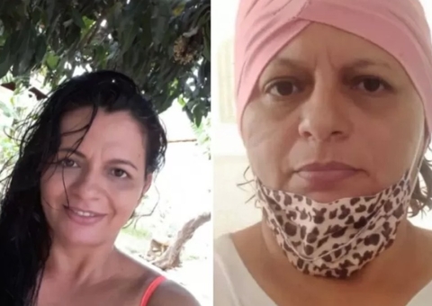 Médico diz que massa é gordura e mulher perde seios meses depois 