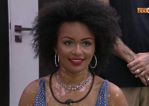Ex-bbb Natália é chamada de ‘Dálmata’ e equipe denuncia ataque racista à polícia