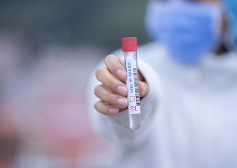 Covid-19: Brasil tem 6.498 casos e 89 mortes em 24 horas