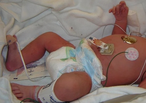 Sete casos de hepatite infantil misteriosa são investigados no Brasil 