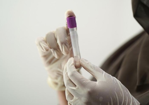 Nova linhagem da Ômicron presente nos EUA é detectada no Brasil