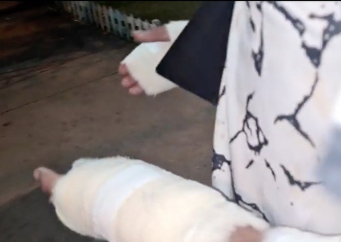 Dupla suspeita de roubo leva tiros nas mãos no Amazonas