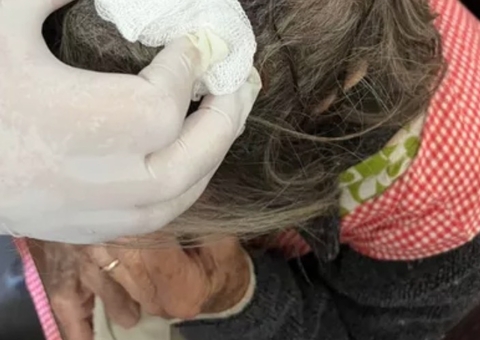 Idosa é encontrada desnutrida e com larvas na cabeça; filho foi preso