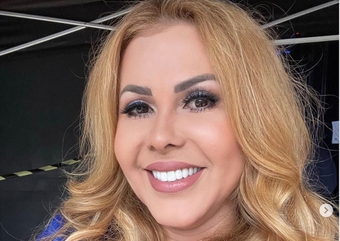 Joelma é internada após inchaço no rosto 