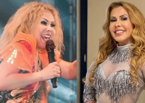 Médica explica que inchaço no rosto de Joelma é combinação de Covid e corticoides 