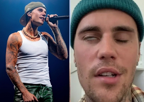 Com metade do rosto paralisado, Justin Bieber revela síndrome rara e pede orações
