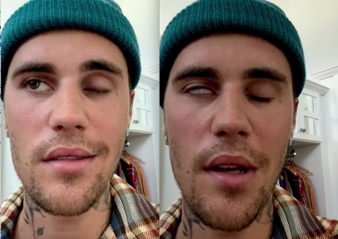 Justin Bieber pede orações após revelar síndrome rara: 'cada vez mais difícil comer'