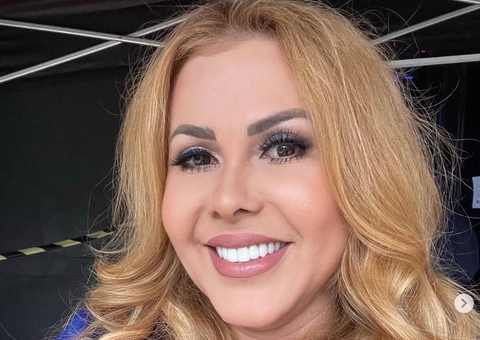 Joelma recebe alta do hospital após inchaço no rosto