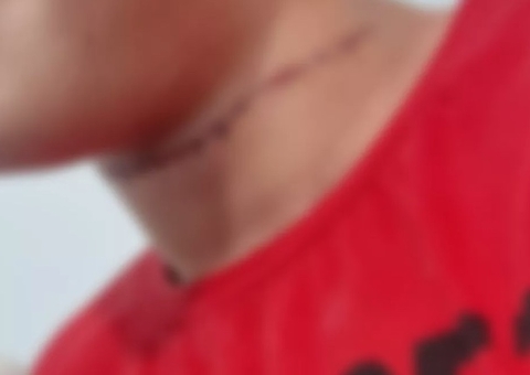 Linha de cerol corta pescoço de menino que andava de bicicleta em parquinho