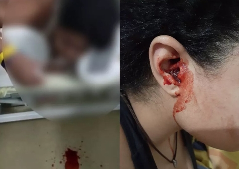 Jovem tem sangramento misterioso por nariz, boca e ouvidos, e passa por cirurgia