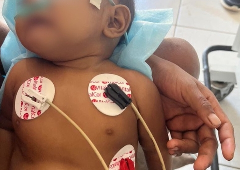 Bebê de 3 meses com dificuldades para respirar é salvo por militares em aldeia Yanomami