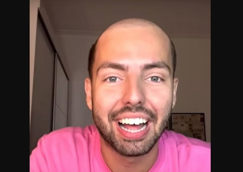 Corte de cabelo que imita calvície vira moda entre brasileiros