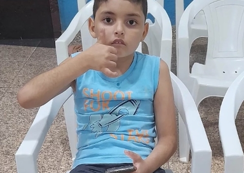 Menino de 8 anos perde a perna e sofre queimaduras ao ser atingido por fio elétrico