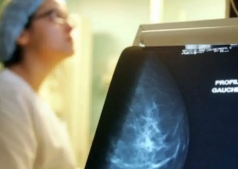 Mulheres com casos de câncer na família podem fazer exames gratuitos no Amazonas