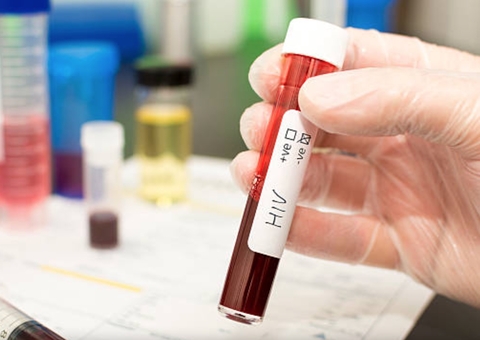 Nova cura de paciente com HIV não é aplicável em larga escala