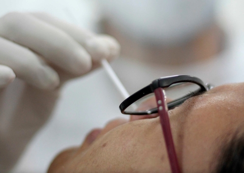 Fiocruz Amazônia faz testes PCR para diagnosticar casos de Varíola dos Macacos em 24h