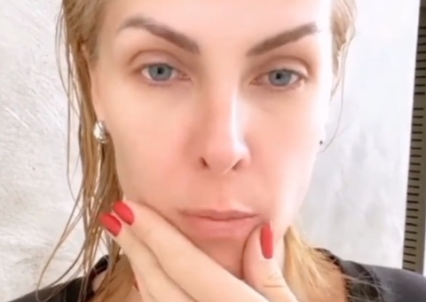Ana Hickmann sofre acidente no banheiro: ‘cortado meu corpo inteiro’ 