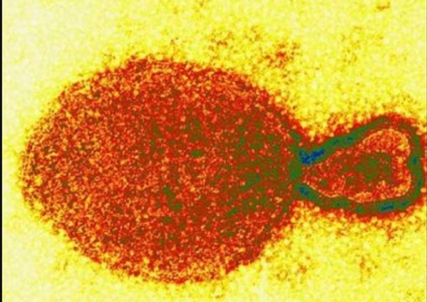 Henipavirus: Veja tudo o que se sabe sobre o novo vírus identificado na China