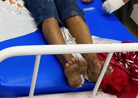 Homem é baleado na cabeça dentro de bar em Manaus