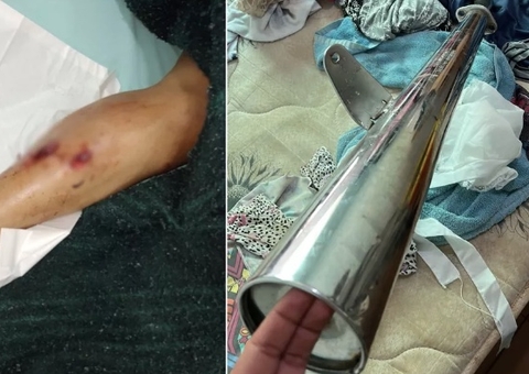 Homem tenta matar esposa com escapamento de moto e queima filho com mingau quente