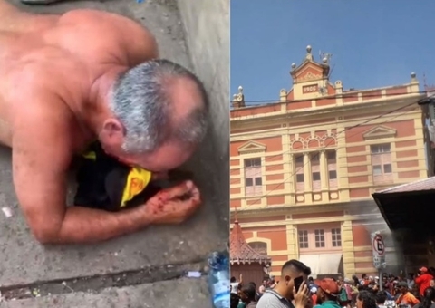 Homem que ateou fogo no Mercado Adolpho Lisboa é internado em estado grave em Manaus