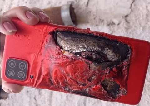 Celular explode na mão de criança de 6 anos enquanto assistia vídeo