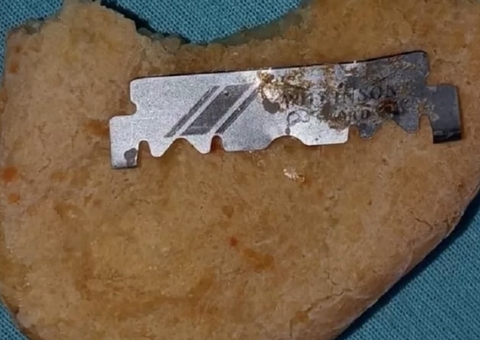 Mulher encontra lâmina de barbear dentro de pão de queijo: 'quase engoliu'