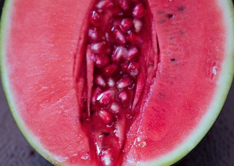 Brasil é líder em cirurgia na pepeca; saiba como é a labioplastia 