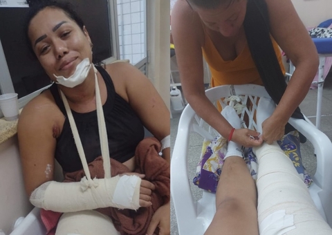 Estudante quebra mandíbula em acidente e família faz vaquinha para pagar cirurgia em Manaus