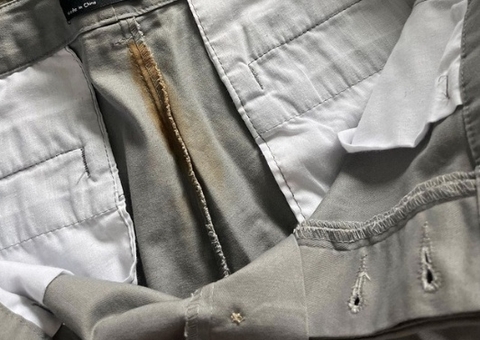 Loja online envia bermuda 'freada' de cocô para cliente