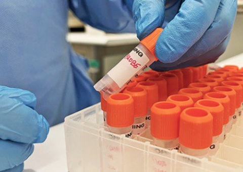 Amazonas chega a 55 casos confirmados de varíola dos macacos