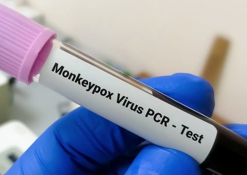 Em uma semana, casos de varíola dos macacos sobem 77% no Amazonas 