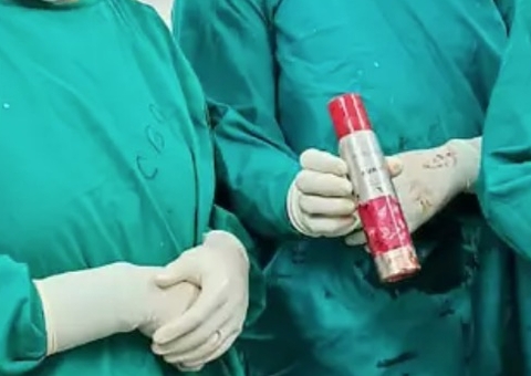 Homem passa 3 semanas com desodorante enfiado no ânus e passa por cirurgia; vídeo