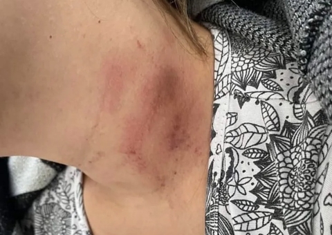 Mulher é espancada por namorado ao ser flagrada dançando com amiga em boate