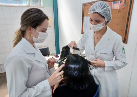 Amazonas registrou mais de 70 casos de alopecia; doença que não tem cura