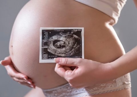 Ministro do STJ nega habeas corpus para mulher realizar aborto de gêmeos siameses