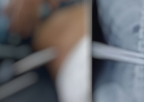 Mulher tenta fugir de macacos e é perfurada por barra de ferro