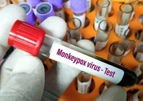 Varíola dos Macacos: Amazonas tem 65 casos suspeitos em investigação