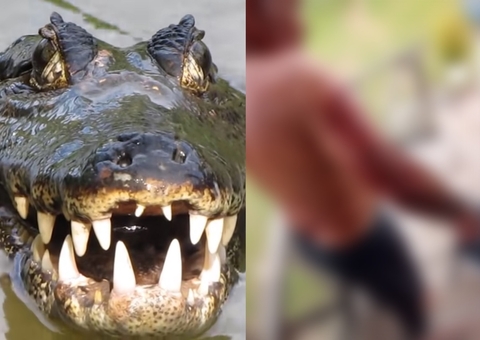 Homem é atacado por jacaré em Manacapuru; Imagens fortes