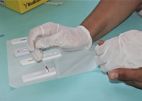 Amazonas contabiliza 4,6 mil casos de Sífilis e FVS oferta testagem rápida em Manaus