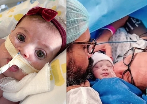 Aos 3 meses, filha de Juliano Cazarré fará nova cirurgia 