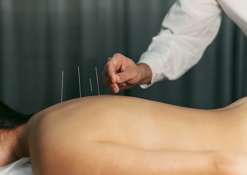 Projeto quer obrigar SUS a ofertar acupuntura e homeopatia
