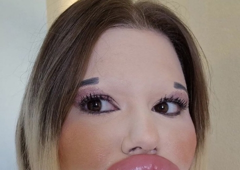 Após 30 preenchimentos, Barbie Humana choca com maior boca do mundo